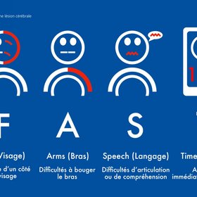 FAST, graphique pour reconnaître les signes d'AVC