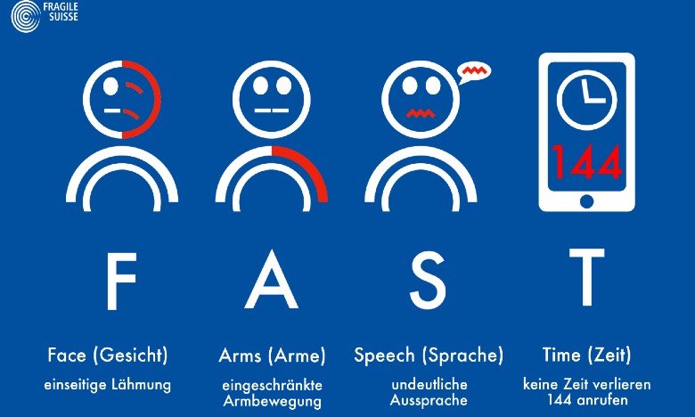 FAST-Test steht für: Face (Gesichtslähmung), Arms (eingeschränkte Armbewegung), Speech (Sprachstörung), Time (144 wählen)